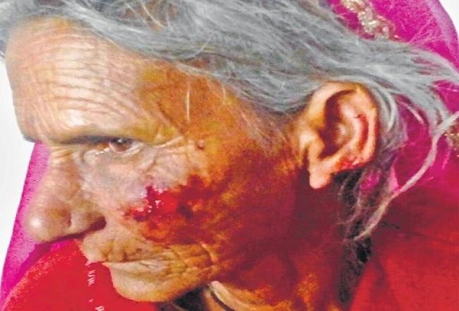 बुजुर्ग महिला के कान काट टॉप्स ले गए लुटेरे, किसी ने नहीं सुनी चीखें
